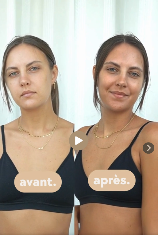 Chloé - Cure de 2 mois